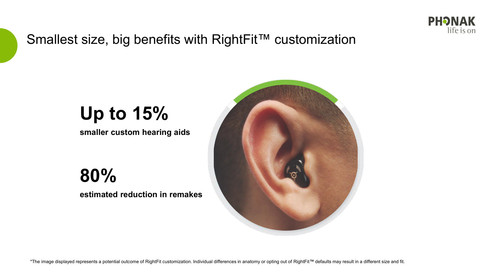 The manufacturing payoff of AI-driven RightFit fitting — up to 15% smaller devices and ~80% fewer remakes.